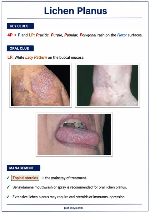 PLAB 1 and UKMLA chapter content preview: Lichen Planus
